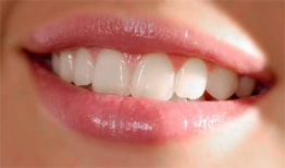 FILLINGS